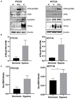 A Novel Mechanism of Ataxia Telangiectasia Mutated Mediated Regulation of Chromatin Remodeling in Hypoxic Conditions